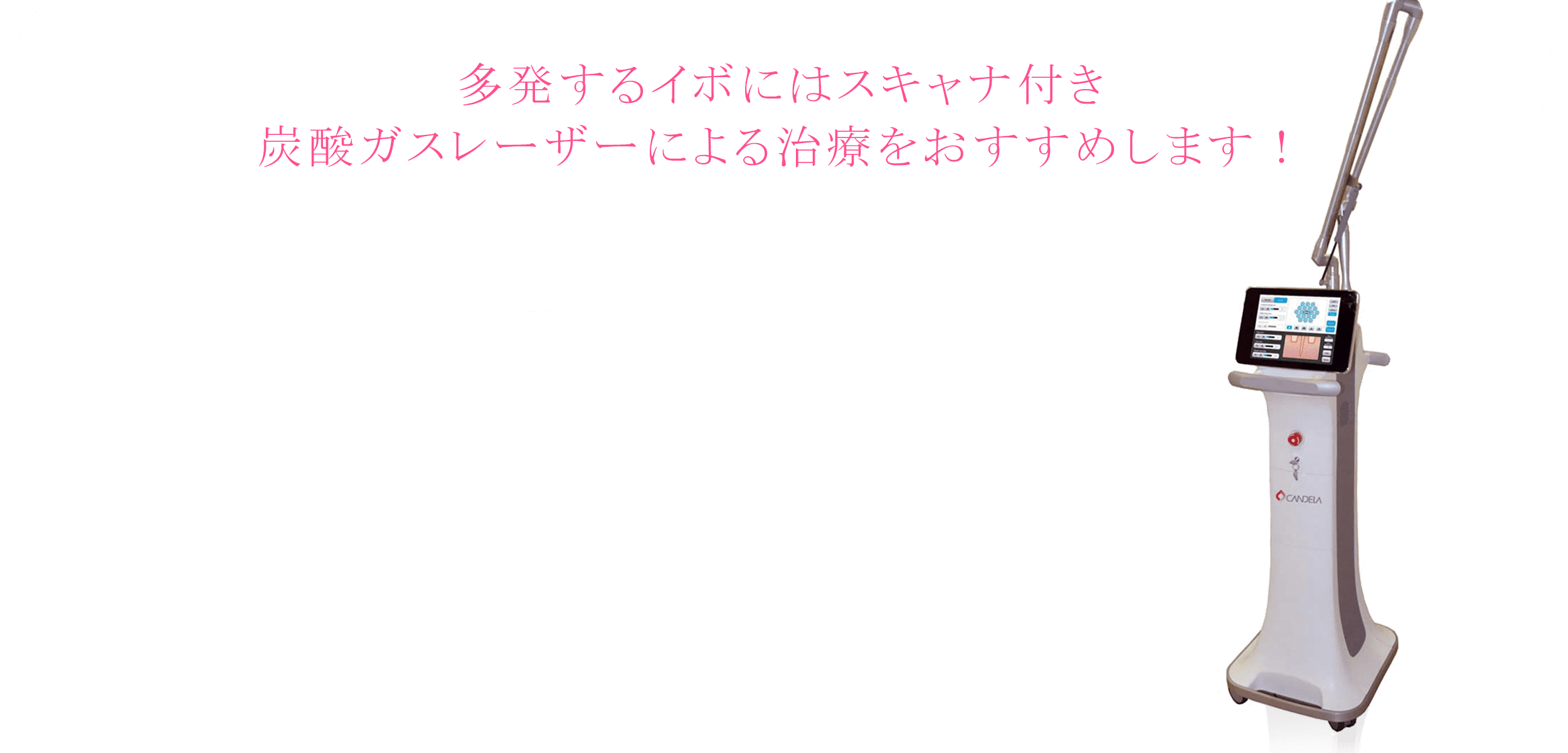 多発するイボにはスキャナ付き炭酸ガスレーザーによる治療をおすすめします！